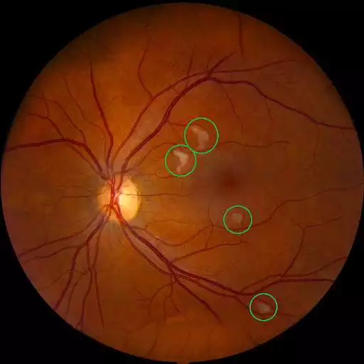 Play VR Ophthalmology Training Simulator (Legacy)