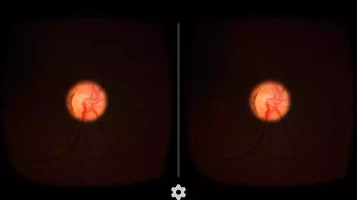 Play VR Ophthalmology Training Simulator (Legacy)