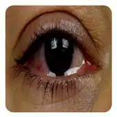 Free play online Watery Eyes APK Free play online Watery Eyes APK