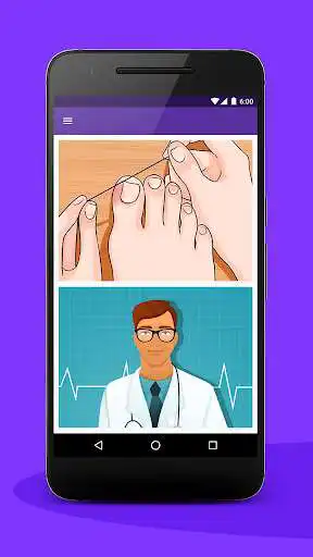 Play Without a single spot  and enjoy Without a single spot with UptoPlay