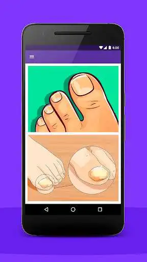 Play Without a single spot as an online game Without a single spot with UptoPlay