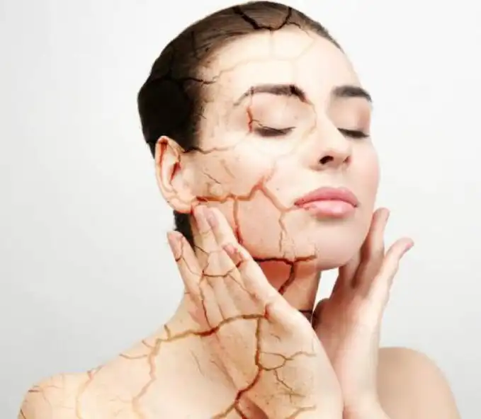 Play Xerosis Naturally Treatment  and enjoy Xerosis Naturally Treatment with UptoPlay