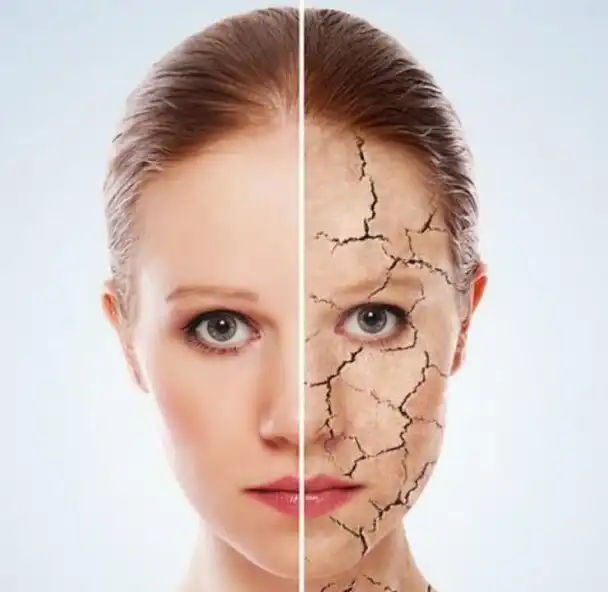 Play Xerosis Naturally Treatment as an online game Xerosis Naturally Treatment with UptoPlay