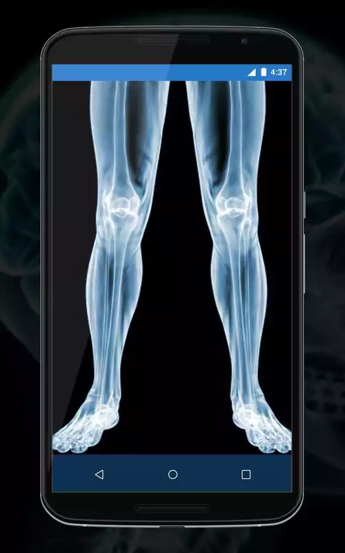Play Xray Camera Scanner