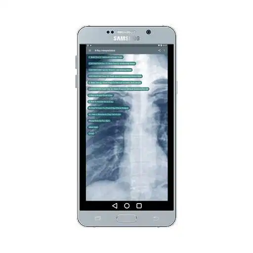 Play X-ray Interpretation for Medical Use as an online game X-ray Interpretation for Medical Use with UptoPlay