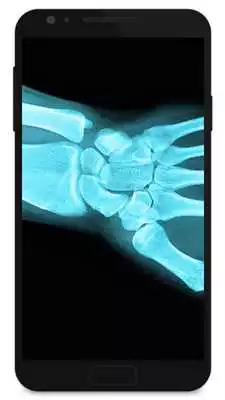 Play X Ray Prank Hand