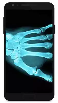 Play X Ray Prank Hand