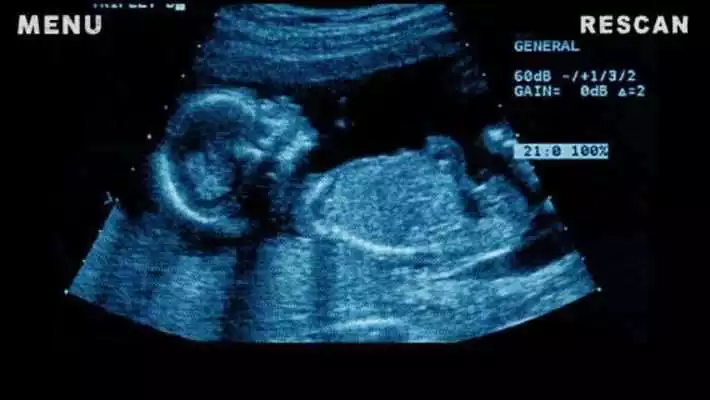 Play X-Ray Scanner Pregnant Joke