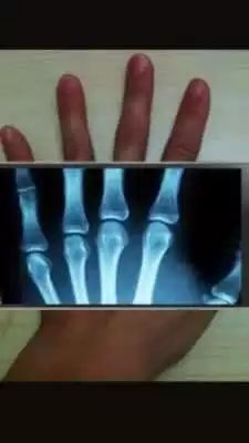 Play XRay Scanner Pro