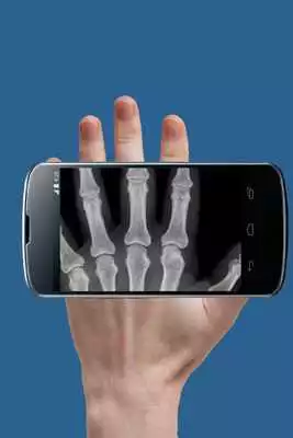 Play XRay Scan Prank Play XRay Scan Prank