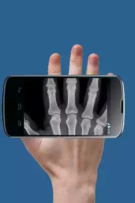 Play XRay Scan Prank Play XRay Scan Prank