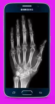 Play X X Ray Scanner App