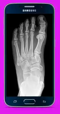 Play X X Ray Scanner App